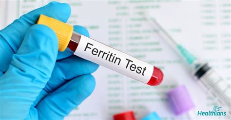 Ferritin Blood Test (High, Low, Normal Levels):。